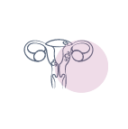 Endoscopia-Histeroscopia