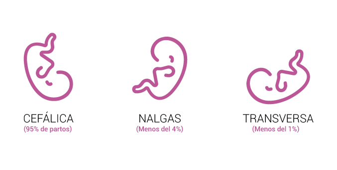 posicion del feto